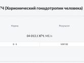 Девочки Я сделала ХГЧ я беременна или нет