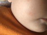 Девочки подскажите аллергия или