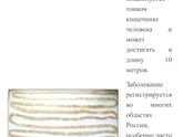 Глисты ?? заранее извиняюсь