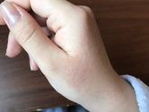 Что может быть?