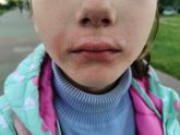 Дочь постоянно облизывает вокруг рта ?