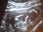 Фотографии на 23 неделе беременности