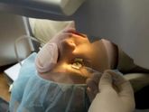 Операция LASIK коррекция зрения,