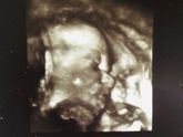 3-D фото 29 недель.