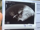 Фотографии на 2 неделе беременности