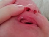 Что это иожет быть на губе?