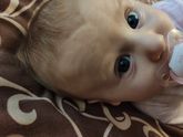 Покраснение под глазиком