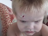 Вот мой раненый боец.