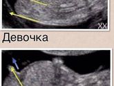 Пол в 12 недель