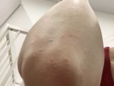 Точки и чешется
