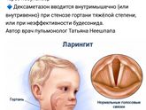 #полезностипост #актуалочка #стеноз #орви