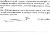 Регультат гистологии после гистероскопии