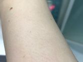 Красные пятна/кровоизлияния?