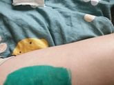 Что это может быть!? Проснулась и обнаружила бляхи от камаров таблетка стоит и именно у меня бляхи только на ноге зуд и жжение …