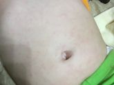 Розеола? Фото добавлю