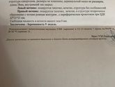 Сходила на узи, как