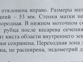Прошла я мрт в