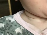 Реакция грудничка на соду?
