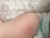 Вчера утром делали прививку