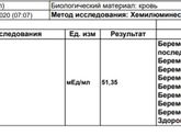 Пришел хгч.