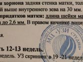 Расширение цервикального канала