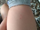 Девушки подскажите что это