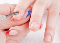 Что такое птеригий на ногтях и как его удалить
