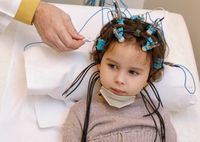 ЭЭГ головного мозга ребенку: показания и расшифровка показателей