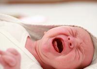 Перелом ключицы новорожденного и его последствия