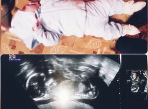CollageMaker_20191127_191742293