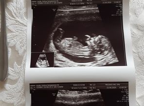 IMG-b3147d1ada8848dbdce8ca3970e35b4f-V