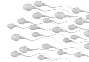 Как вылечить агглютинацию сперматозоидов и стать папой