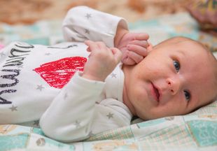 Как выглядит гормональная сыпь у новорожденных и когда она пройдет?