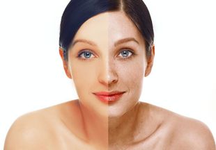 Как улучшить цвет лица: домашние маски, массаж, витамины