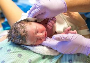 Чтобы мамы не волновались: акушер пояснил, как роды влияют на форму головы новорожденного