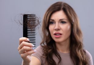 Выпадают волосы: эксперты посоветовали, как это остановить