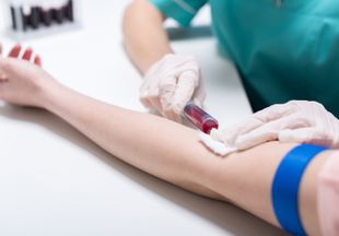 АЧТВ: норма у женщин в крови и расшифровка анализов
