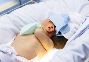 Формы геморрагической болезни новорожденных