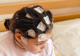 Можно ли вылечить эпилепсию у детей