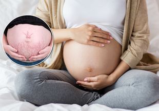 4 доступных способа: как не допустить появления растяжек на коже во время беременности