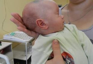Водянка головного мозга у новорожденных: симптомы и лечение