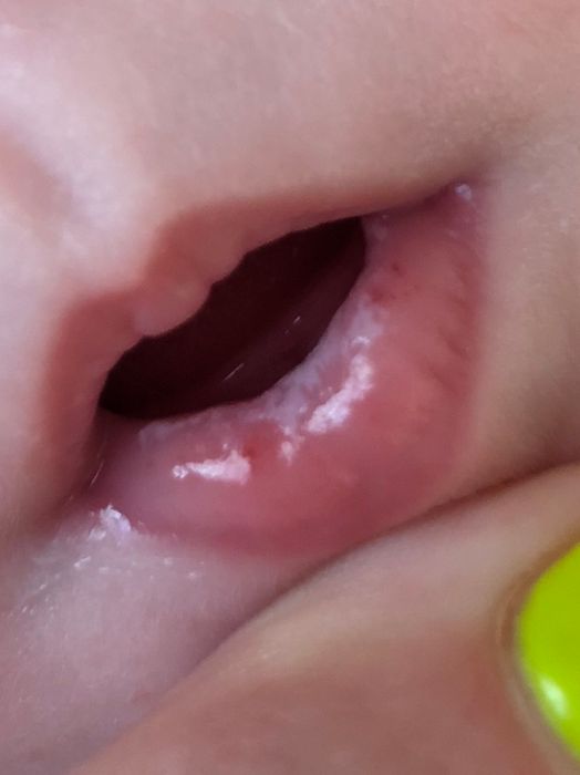 Что это может быть на губе?