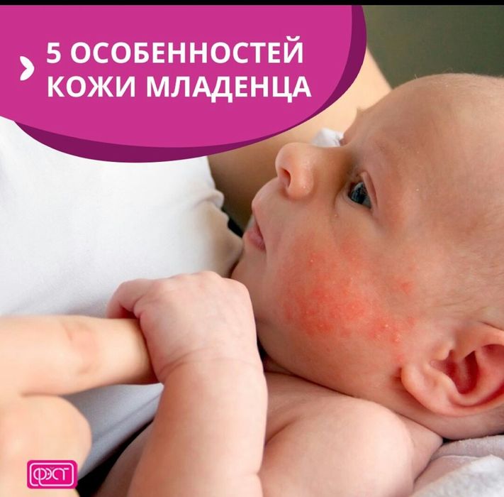 5 особенностей кожи младенца