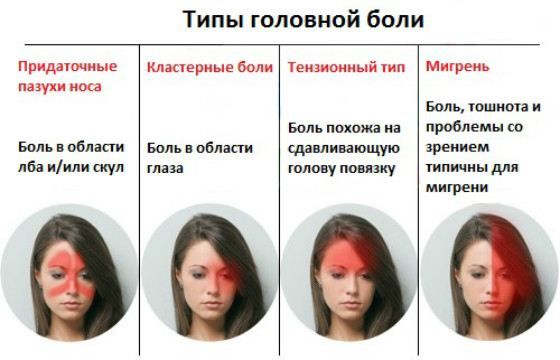 Мигрень