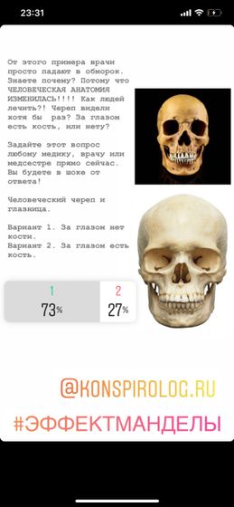 Как то уже писала