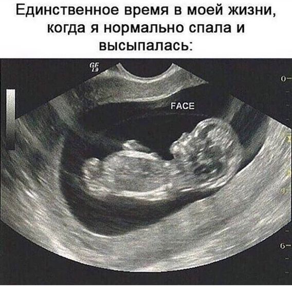 Это точно про меня!