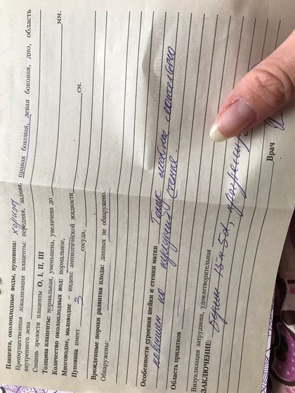 Тонус