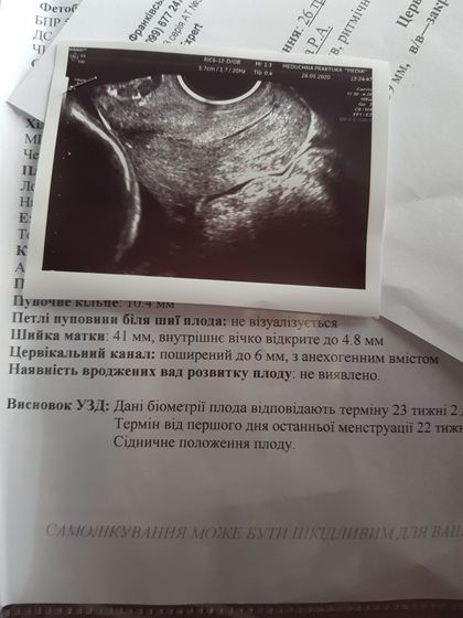 Мнимая ИЦН? Гневный пост.