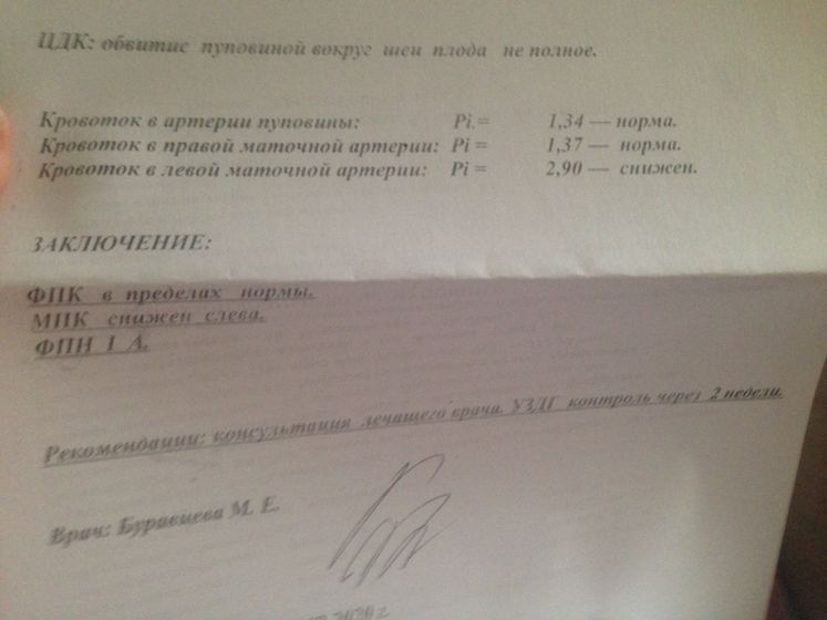 Экватор