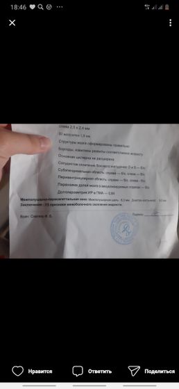 Кто сталкивался что к